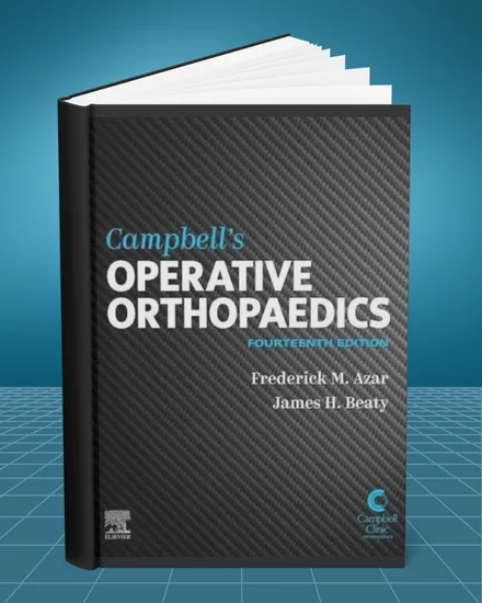 Campbells Operative Orthopaedics Four Volume Set 14th edition