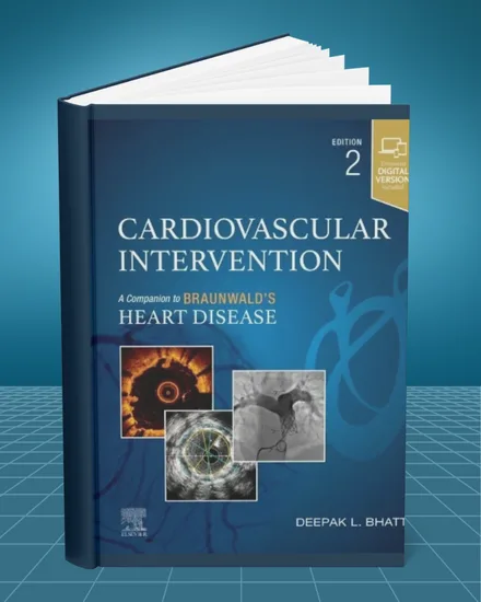 Cardiovascular Intervention 2nd edition book cover