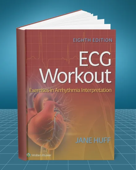 ECG Workout Exercises in Arrhythmia Interpretation 8th edition